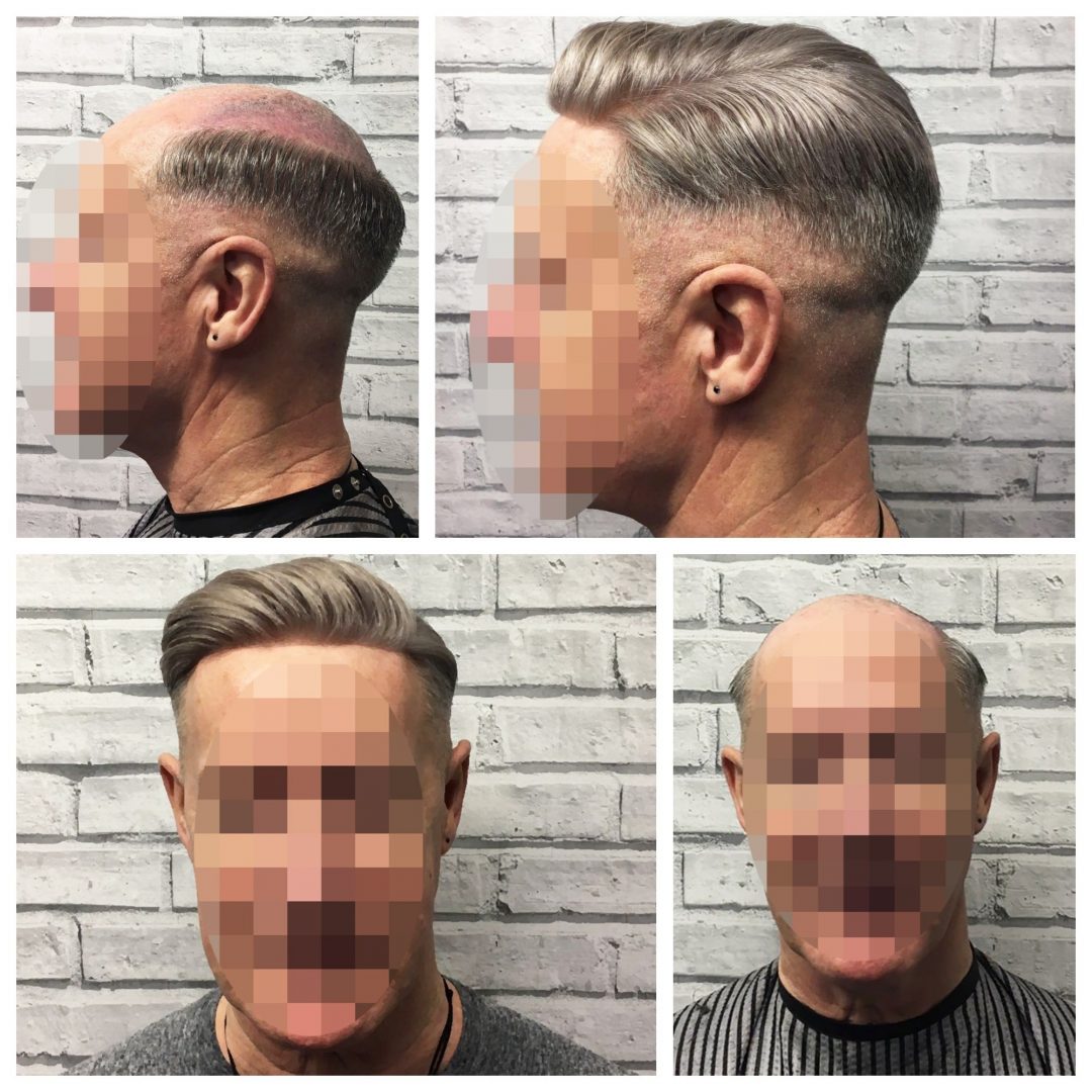 Pricing Hair Systems Manchester